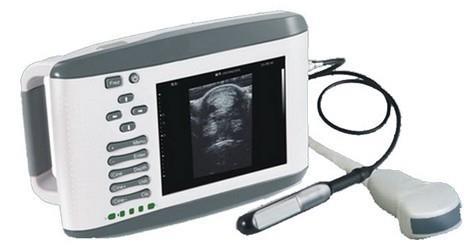 Palm Ultrasound