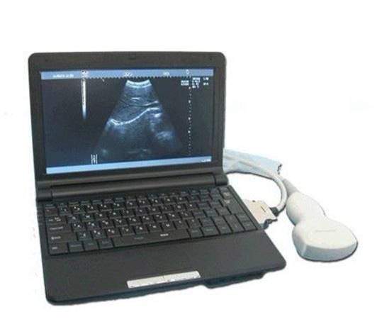 KR-2088Z Laptop Full Digital Ultrasound