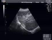 Ultrasound Images