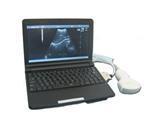 KR-2088Z Laptop Full Digital Ultrasound